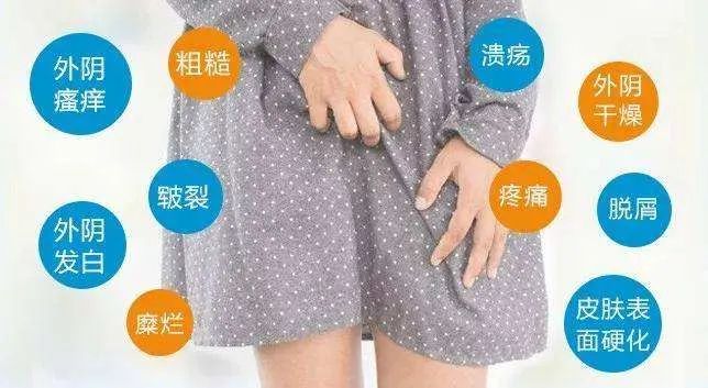 外阴白斑为什么会导致外阴瘙痒？